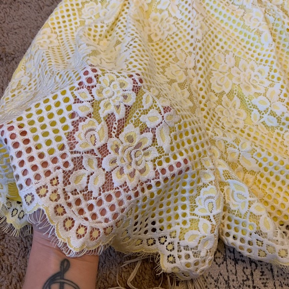 Lace Romper 🍋 - Picture 3 of 8